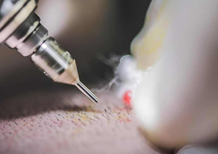 Close-up of a tattoo machine needle touching the skin during a tattooing session, with a small plume of ink and steam nearby.