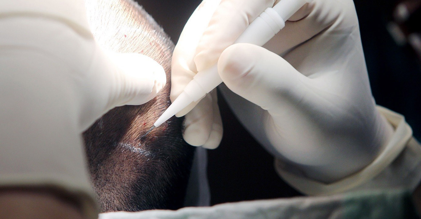 Close-up of a surgeon's gloved hands making a small skin incision with a scalpel during a medical procedure.